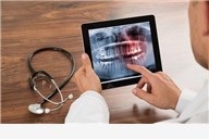 Digitalni ortopan s pregledom - kvalitetna i čista snimka cijele čeljusti u Ordinaciji dentalne medicine Čeko!
