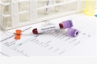Kompletne pretrage iz krvi i urina + testiranje hormona štitnjače