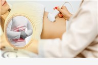Bolovi u trbušnoj šupljini mogu upozoravati na niz problema - obavite ultrazvuk i pregled abdomena u Poliklinici Đurić - Obavite važan pregled za rano otkrivanje bolesti organa trbušne šupljine
